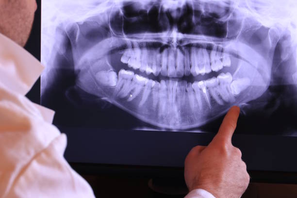 Best Broken or Chipped Tooth Repair in Marist College, NY